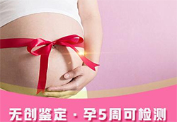 怀孕了天津怎么做产前亲子鉴定，天津做孕期亲子鉴定准确吗